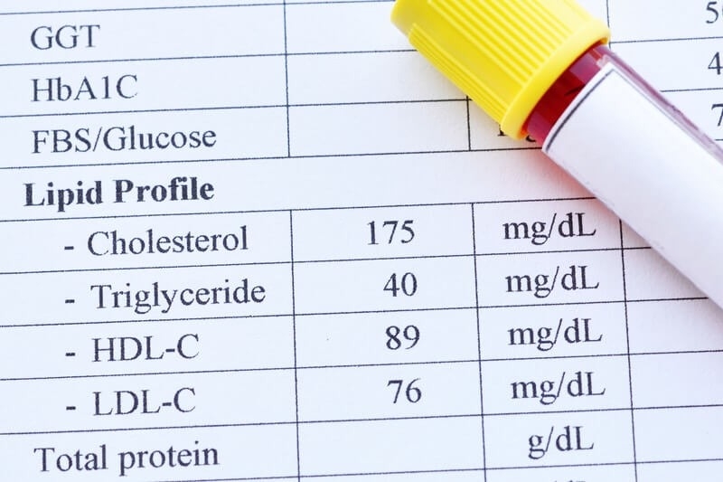 kết quả xét nghiệm cholesterol